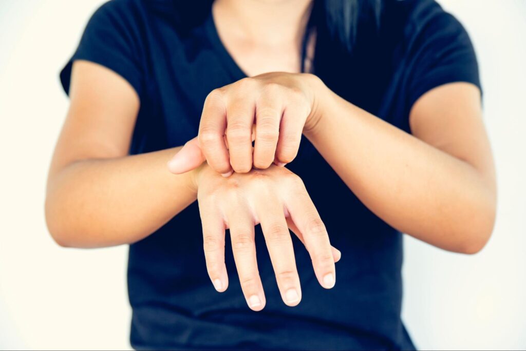 プラチナ 金属アレルギー