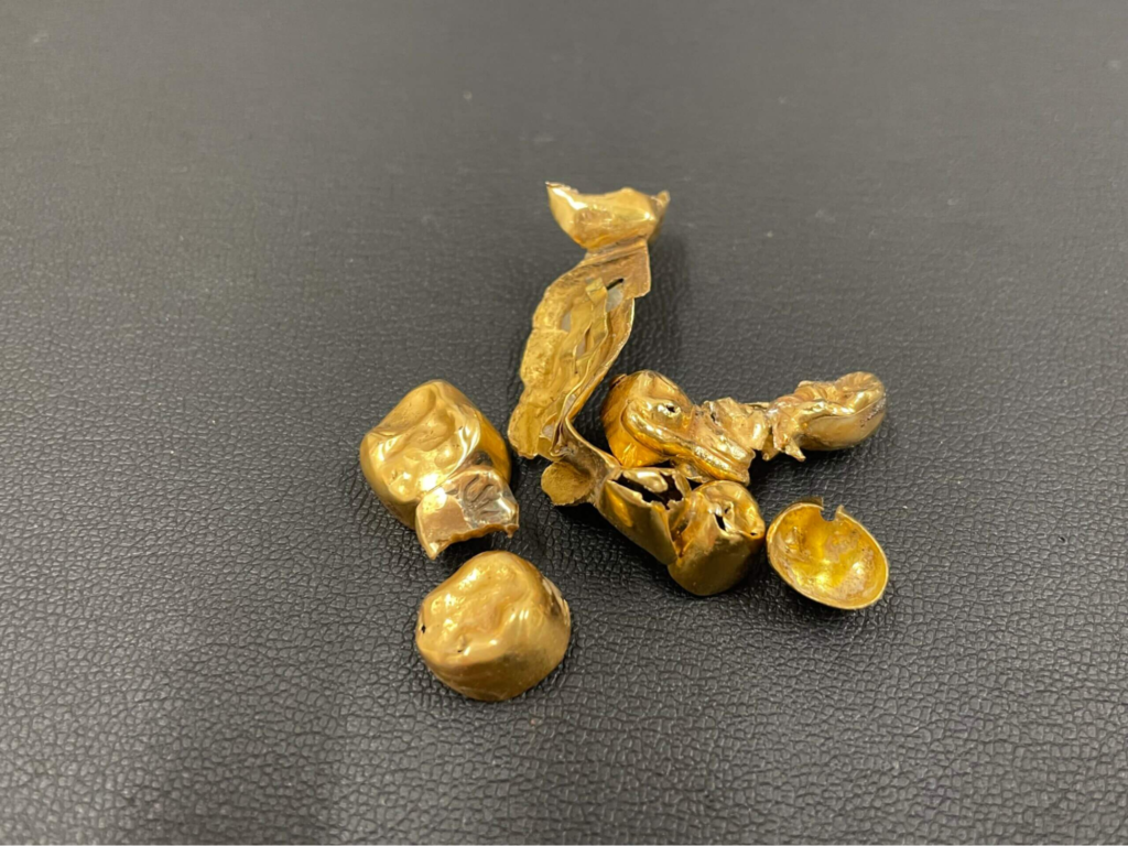 金歯 いくらで売れる