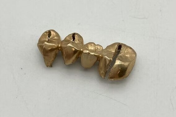 金歯 いくらで売れる