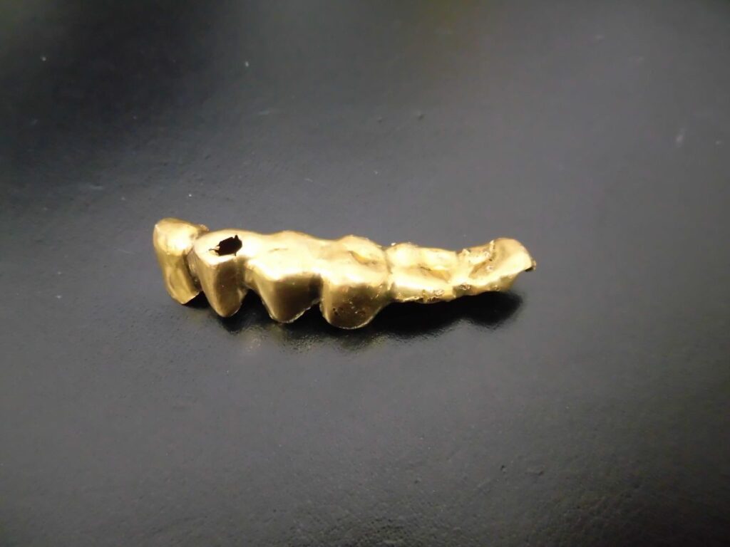 金歯 いくらで売れる