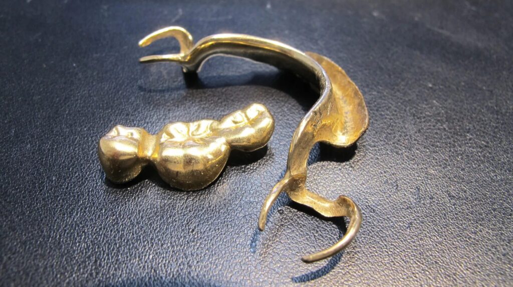 金歯 いくらで売れる